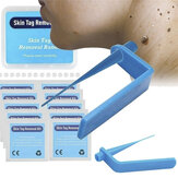 Micro Skin Tag Remover Kit για οικιακή χρήση Μικρές έως μεσαίες ετικέτες δέρματος Body Effective Mole wart Remover Skin Tag band