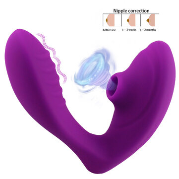 Vagina Sucking Vibrator 10 Speeds Vibrating Sucker Oral Sex Suction Clitoris Stimulator Erotic Sex Toys for Women Sexual Wellness